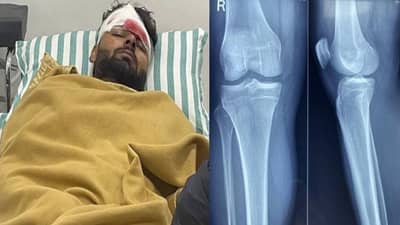 Rishabh Pant Accident ऋषभ पंत याच्या करिअरला धक्का? गुडघ्याचा एक्स-रे पाहून लावला जातोय कयास