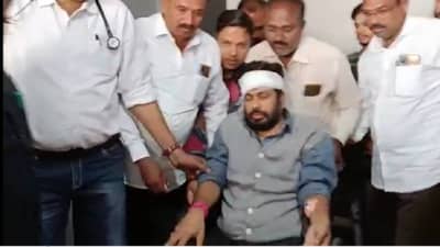 बच्चू कडू यांना अपघातानंतर तातडीने अमरावतीहून नागपूरला नेले; बच्चू कडू यांची पहिली प्रतिक्रिया काय?