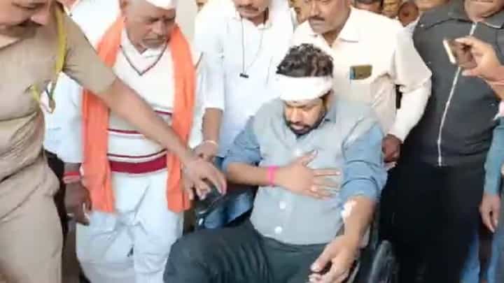 बच्चू कडू यांचा अपघात, पुढील उपचारासाठी नागपुरात हलवलं... बच्चू कडू यांचा अपघात, पुढील उपचारासाठी नागपुरात हलवलं...