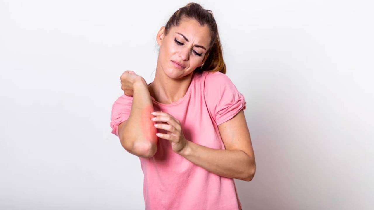 Foods to Avoid in Eczema: सतत खाजेमुळे वैतागला असाल तर 'हे' पदार्थ खाणं आजच बंद करा Foods to Avoid in Eczema: सतत खाजेमुळे वैतागला असाल तर 'हे' पदार्थ खाणं आजच बंद करा