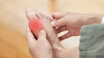 Uric Acid: युरीक ॲसिड वाढल्यास शरीराच्या या भागात जाणवते तिव्र वेदना, दुर्लक्ष करणे पडू शकते महागात