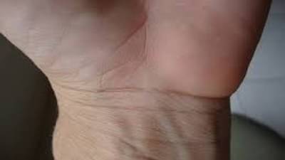 Astrology: भाग्यवान लोकांच्या हातावर असते अशा प्रकारची ब्रेसलेट लाईन, काय असतात याचे फायदे?