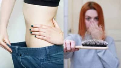 Hair Loss in Dieting : वजन कमी करणे आणि केसगळती यांचा काय संबंध ? जाणून घ्या सर्वकाही..