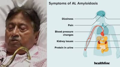 पाकचे माजी राष्ट्रपती परवेज मुशर्रफ यांचा गंभीर आजाराने मृत्यू; काय आहे एमाइलॉयडोसिस आजार? कशामुळे होतो?