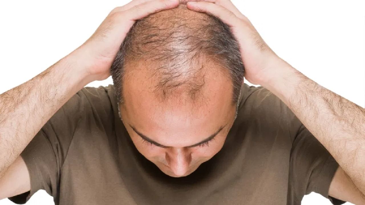 स्वप्नात तुम्ही स्वत:ला टक्कल पडल्याचं पाहिलं का? यामागचं शास्त्र जाणून घ्या स्वप्नात तुम्ही स्वत:ला टक्कल पडल्याचं पाहिलं का? यामागचं शास्त्र जाणून घ्या