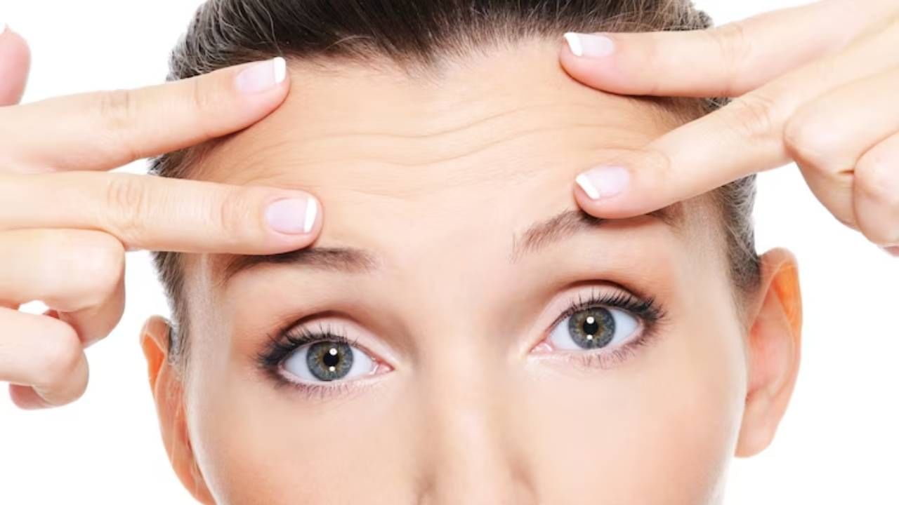 सुरकुत्या - व्हिटॅमिन सीच्या कमतरतेमुळे चेहऱ्यावर बारीक रेषा आणि सुरकुत्या येण्याची समस्या वाढू शकते. जेव्हा शरीराला पुरेसे व्हिटॅमिन सी मिळत नाही, तेव्हा त्वचेवर कोरडेपणा येतो आणि कपाळ, डोळ्याभोवती आणि ओठांच्या आसपास त्वचेवर सुरकुत्या आणि बारीक रेषा दिसू लागतात.
