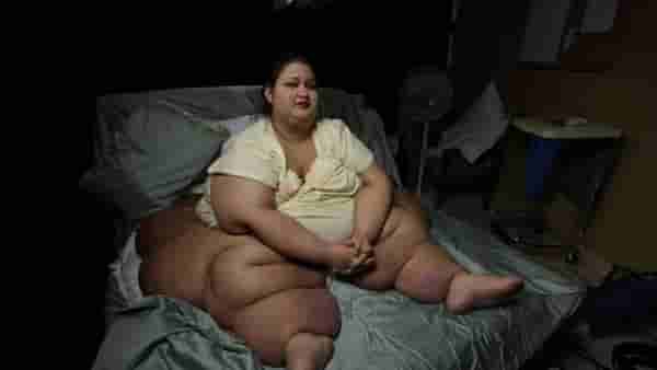 Over Weight Woman : 450 किलो वजन, पण महिलेने 362 किलो कमी केलं, घराचं दार तोडून बाहेर काढलं होतं,आता खिडकीतूनही..