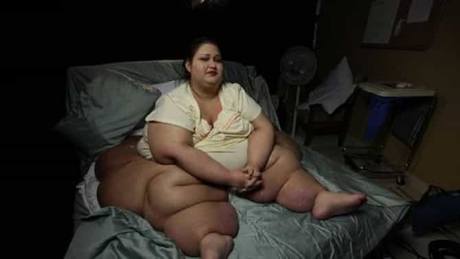 Over Weight Woman : 450 किलो वजन, पण महिलेने 362 किलो कमी केलं, घराचं दार तोडून बाहेर काढलं होतं,आता खिडकीतूनही..