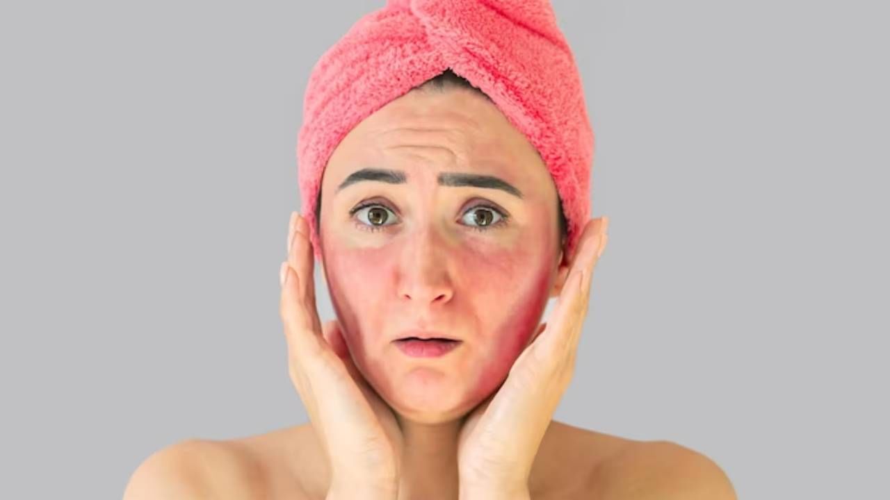 Bleach Burn : केमिकलयुक्त ब्लीचमुळे त्वचेचे होऊ शकते नुकसान, जाणून घ्या ब्लीच बर्नवर उपाय Bleach Burn : केमिकलयुक्त ब्लीचमुळे त्वचेचे होऊ शकते नुकसान, जाणून घ्या ब्लीच बर्नवर उपाय