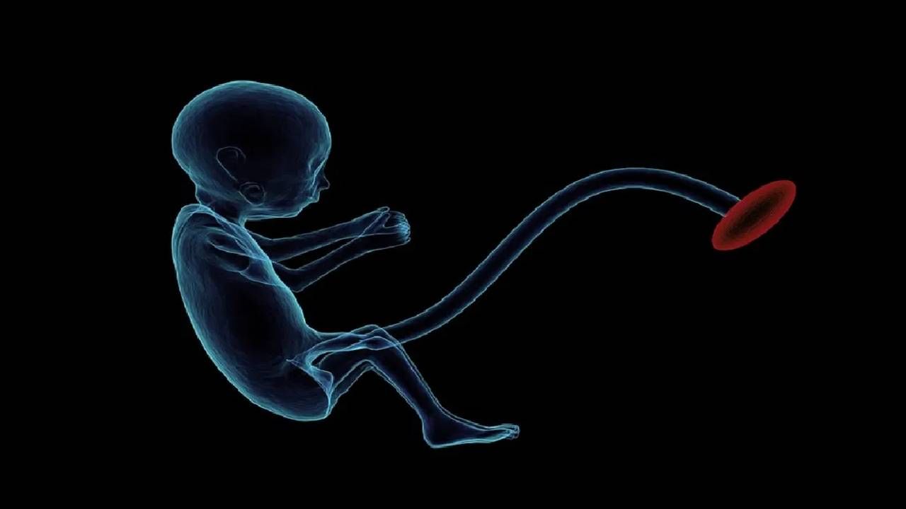 SHOCKING ! चक्क मुलीच्या डोक्यात गर्भधारणा, विज्ञानालाही आव्हान; जगाला कोड्यात टाकणारी घटना कुठे घडली?