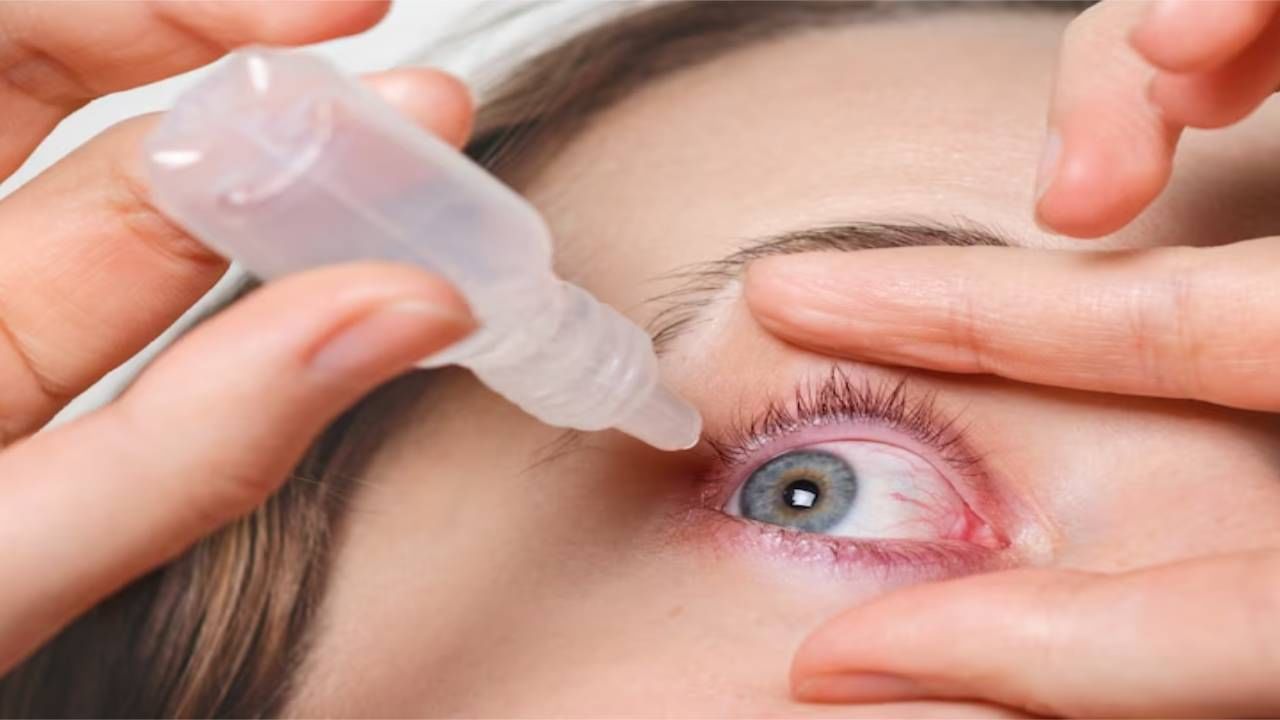तुम्हीही Eye Drop वापरता ? प्रिकॉशन वाचले का ? बाटली उघडल्यावर 28 दिवसांनंतर एक थेंबही वापरू नका, अन्यथा गमवावी लागेल दृष्टी तुम्हीही Eye Drop वापरता ? प्रिकॉशन वाचले का ? बाटली उघडल्यावर 28 दिवसांनंतर एक थेंबही वापरू नका, अन्यथा गमवावी लागेल दृष्टी