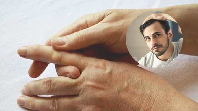 खरंच की काय ! बोटांच्या रचनेवरून डोक्यावर केस टिकणार की नाही ते कळतं, जाणून घ्या लक्षणं