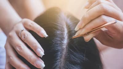 आधीपासूनच घ्या काळजी, केस पांढरे होऊ नये म्हणून आहारातच करा या गोष्टींचा समावेश