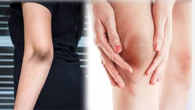 काळपट गुडघे आणि कोपरांमुळे वैतागलात ? या घरगुती उपायांनी काळसरपणा करा दूर, त्वचाही होईल चमकदार