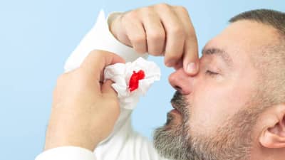 उन्हाळ्यात नाकातून रक्त का येतं ? अशावेळी काय करावं ?