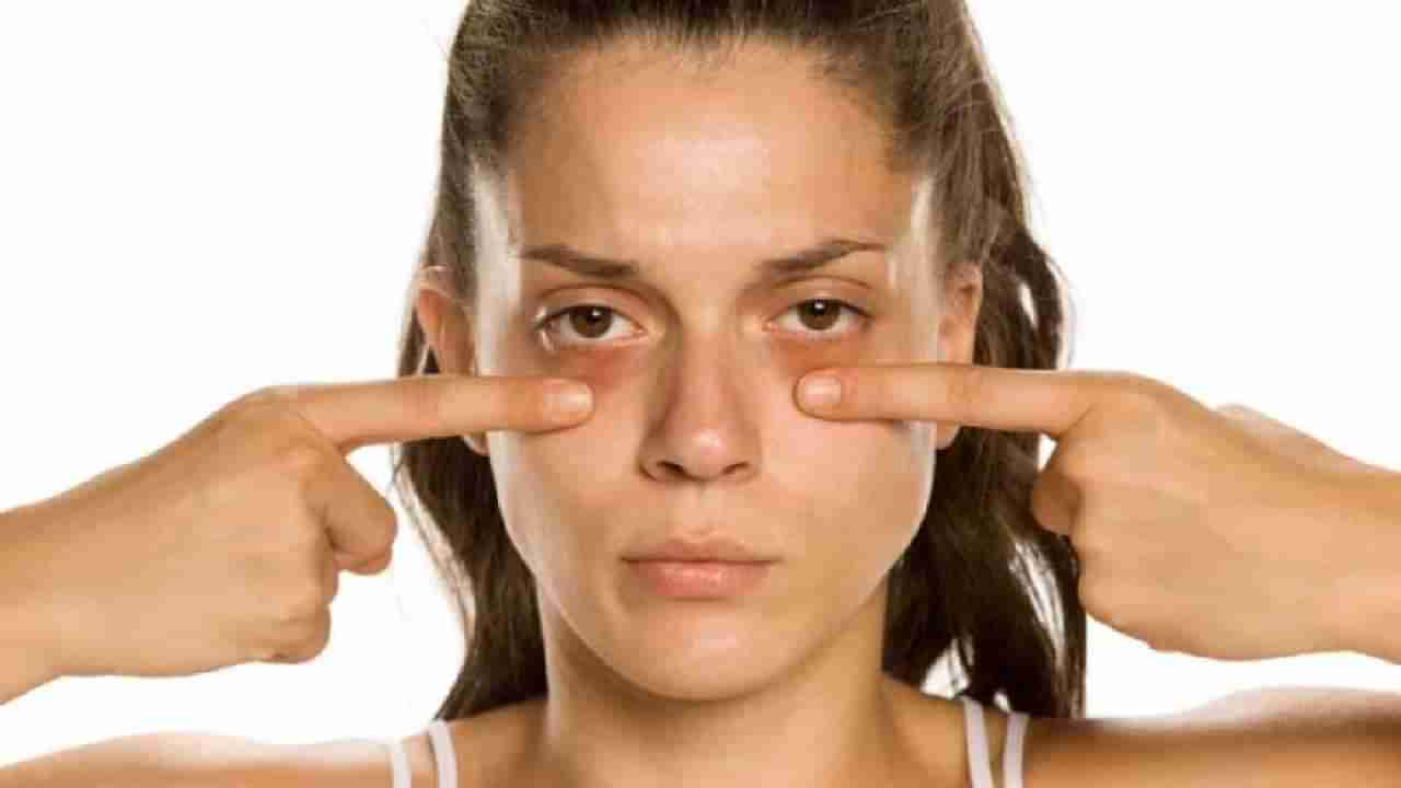 Dark Circles ने केलं परेशान? घरीच बनवा कॉफी अंडर आय मास्क