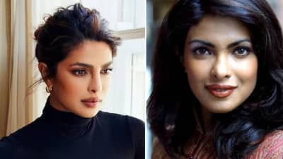Priyanka Chopra | नाकाच्या सर्जरीदरम्यान प्रियांकासोबत घडली ही घटना; बिघडला चेहरा, बऱ्याच वर्षांनंतर खुलासा