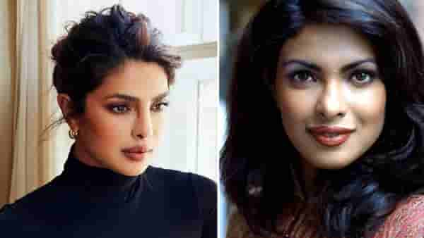 Priyanka Chopra | नाकाच्या सर्जरीदरम्यान प्रियांकासोबत घडली ही घटना; बिघडला चेहरा, बऱ्याच वर्षांनंतर खुलासा
