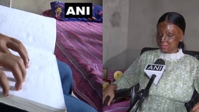 अॅसिड हल्ल्यात वाचलेली मुलगी दहावीत आली टॉप, वडील शिपायाचे काम करतात, अंध असूनही मिळविले 95.2 टक्के