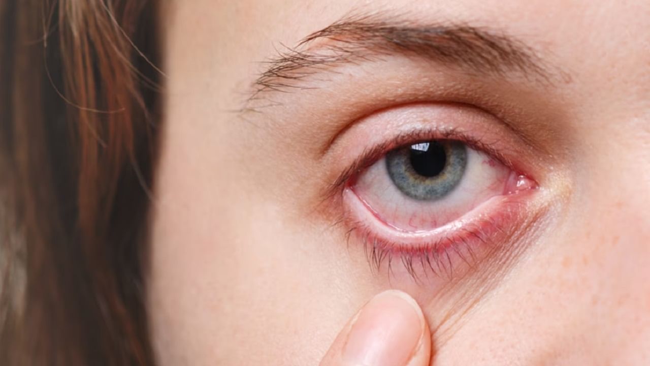 एअर कंडिशनरच्या वापरामुळे डोळ्यांना कोरडेपणा येऊ शकतो. यामुळे आरोग्याची हानी होऊ शकते आणि डोळ्यांना त्रास होऊ शकतो, ज्यामुळे विविध त्रासाचा सामना करावा लागू शकतो.