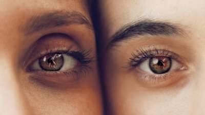 Dark Circles | डार्क सर्कलवर घरगुती आणि कायमस्वरूपी उपाय!