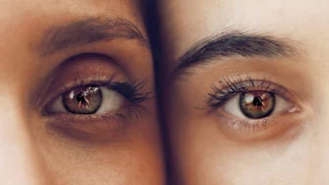 Dark Circles | डार्क सर्कलवर घरगुती आणि कायमस्वरूपी उपाय!