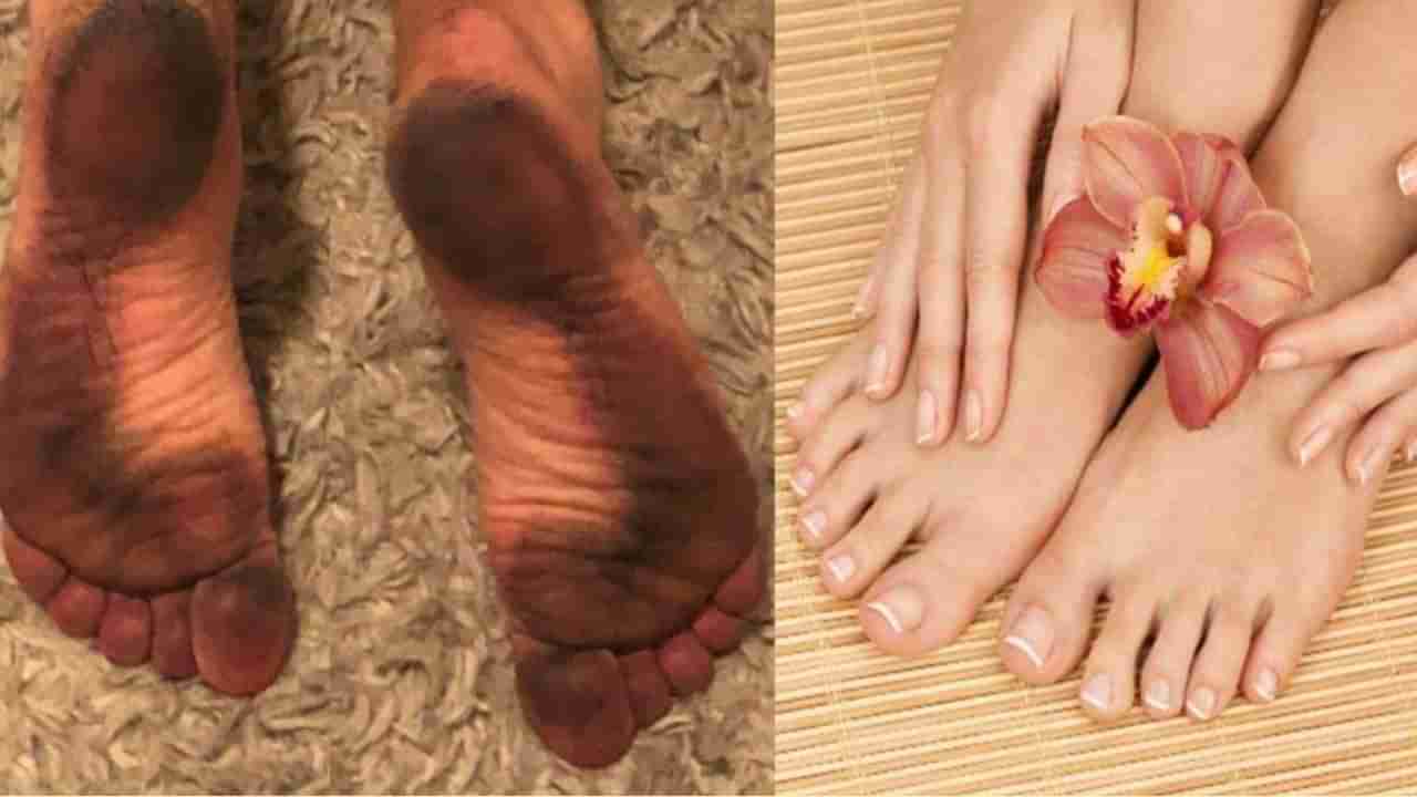 Feet Cleaning : पायाचे तळवे पडलेत काळेकुट, करा हा घरगुती उपाय मग पाहा चमत्कार!