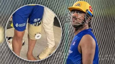 MS Dhoni Knee Surgery : एमएस धोनीवर कुठल्या डॉक्टरने ऑपरेशन केलं? त्यांचं नाव काय?