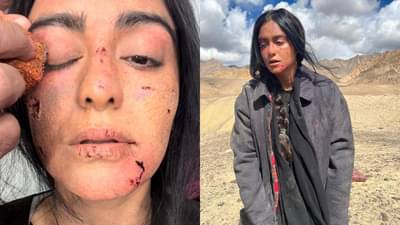 The Kerala Story | अदा शर्माच्या चेहऱ्यावर जखमेच्या खुणा; फोटो पाहून चाहत्यांनी व्यक्त केली चिंता