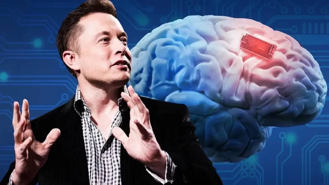 Elon Musk Brain Chip : मेंदूत बसविणार चिप! एलॉन मस्क निसर्गाला देणार आव्हान, क्रांतीकारक न्यूरालिंक प्रोजेक्ट आहे तरी काय
