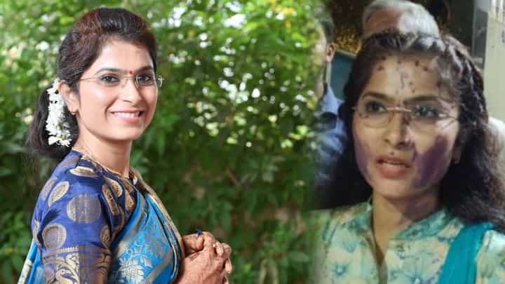 पुन्हा ठाण्यात राजकारण पेटलं; शाईफेकनंतर अयोध्या पोळ यांची पहिली प्रतिक्रिया; म्हणाल्या, ‘बनाव करून...’ पुन्हा ठाण्यात राजकारण पेटलं; शाईफेकनंतर अयोध्या पोळ यांची पहिली प्रतिक्रिया; म्हणाल्या, ‘बनाव करून...’