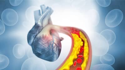 Cholesterol: या 4 आयुर्वेदिक गोष्टी कोलेस्ट्रॉलला हानी पोहोचवण्यापासून वाचवतात, तुम्हीही घ्या फायदा!