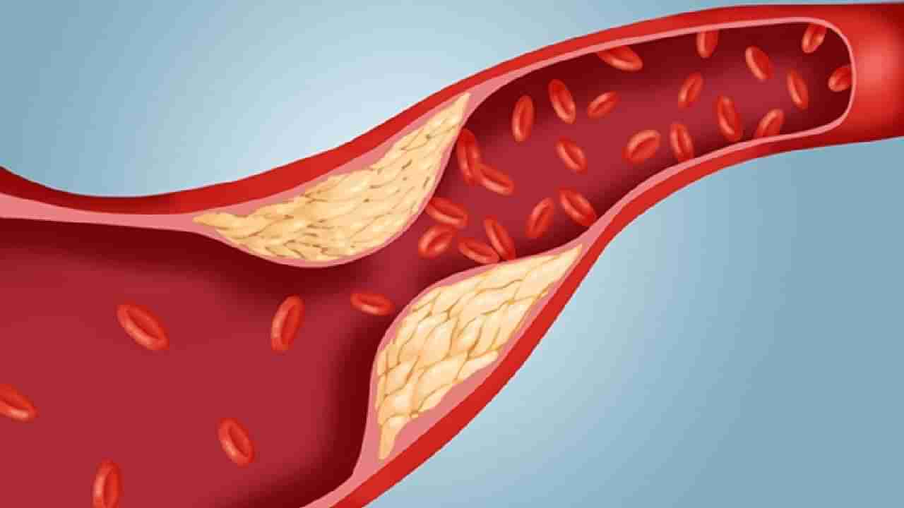 वयाच्या चाळिशीत Cholesterol कमी करतील हे 6 उपाय, Heart Attack ची येणार नाही वेळ!