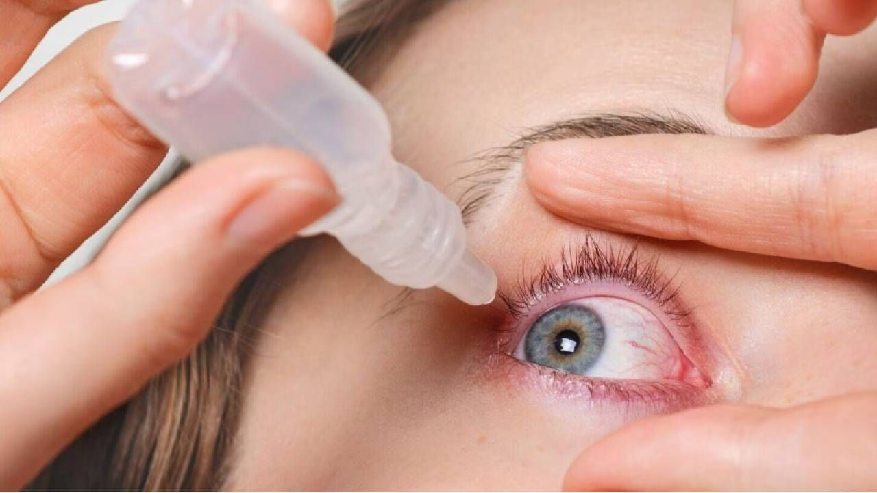 Eye Flu : डोळ्यांच्या आजारापासून बचाव करायचा आहे? या सोप्या गोष्टी अवश्य पाळा Eye Flu : डोळ्यांच्या आजारापासून बचाव करायचा आहे? या सोप्या गोष्टी अवश्य पाळा