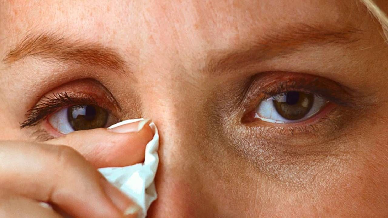 डोळे संसंर्ग साथीचा उद्रेक! राज्यात एक लाख 87 हजार रुग्ण