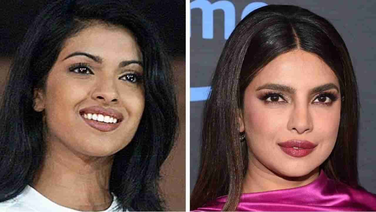 Priyanka Chopra | इतना खराब चेहरा; प्रियांका चोप्राच्या नाकाच्या सर्जरीबद्दल गदर 2चे दिग्दर्शक असं का म्हणाले?