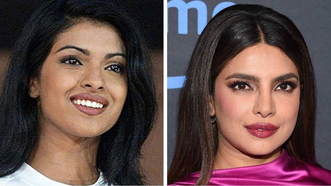 Priyanka Chopra | इतना खराब चेहरा; प्रियांका चोप्राच्या नाकाच्या सर्जरीबद्दल 'गदर 2'चे दिग्दर्शक असं का म्हणाले?