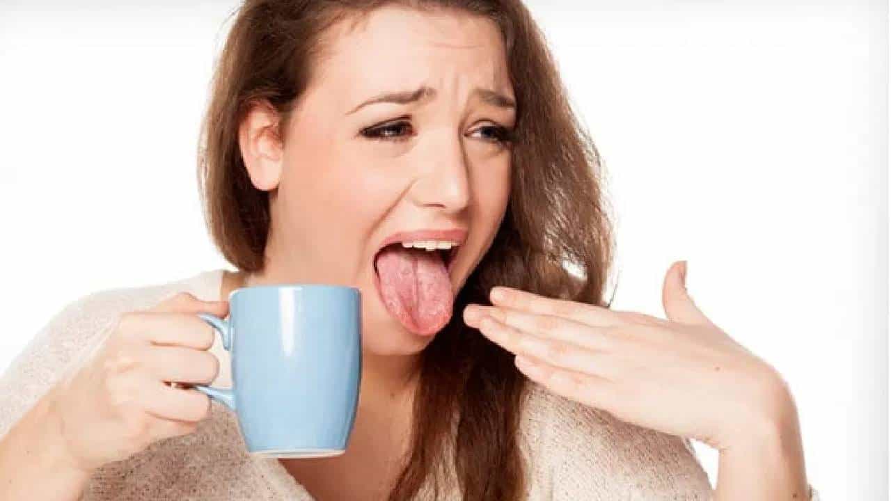 सध्याच्या धावपळीच्या जीवनशैलीत, नीट खायला-प्यायला वेळ नसतो. अशा वेळी घाईत असताना एखादा गरम पदार्थ किंवा पेय खाल्ल्या-प्यायल्याने जीभ भाजू शकते. आपल्यापैकी बऱ्याच जणांना हा अनुभव कधी ना कधी आला असेल. अशा वेळी जीभ बराच वेळ हुळहुळत राहते, काहीच खाता येत नाही. वेदनाही होत असतात. हा त्रास कमी करण्यासाठी काही घरगुती उपाय केल्यास आराम मिळू शकतो. (Photo : Freepik)