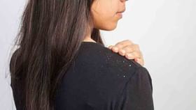 Dandruff : कोंडा होण्याची समस्या वाढली आहे का तर करा हे घरगुती उपाय Dandruff : कोंडा होण्याची समस्या वाढली आहे का तर करा हे घरगुती उपाय