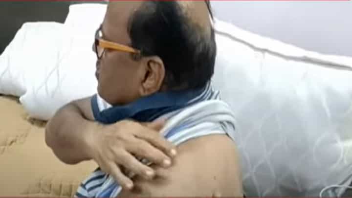 भाजप खासदारावर अज्ञातांनी भिरकावला दगड, खांद्याला झाली दुखापत भाजप खासदारावर अज्ञातांनी भिरकावला दगड, खांद्याला झाली दुखापत