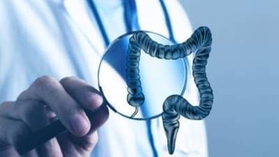 Ulcerative Colitis च्या रुग्णांची टाळावे हे 4 पदार्थ, आतड्यांवर करतात दुष्परिणाम