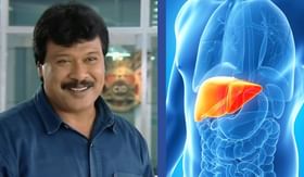 CID फेम फ्रेडीचे लिव्हर फेलियरमुळे निधन, का होते लिव्हर फेलियर CID फेम फ्रेडीचे लिव्हर फेलियरमुळे निधन, का होते लिव्हर फेलियर