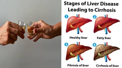 दररोज मद्यपान केल्यास किती दिवसांत डॅमेज होतं लिव्हर ? लक्षणं काय ?