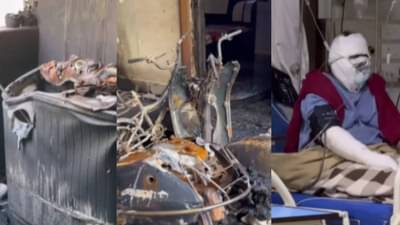 Electric scooter मध्ये स्फोट, एकाच कुटुंबातील 7 जण रुग्णालयात, Video