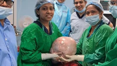 महिलेच्या पोटातून डॉक्टरांनी काढली 10 किलोची गाठ, डॉक्टरांनी अवघड शस्रक्रिया करुन वाचविले प्राण