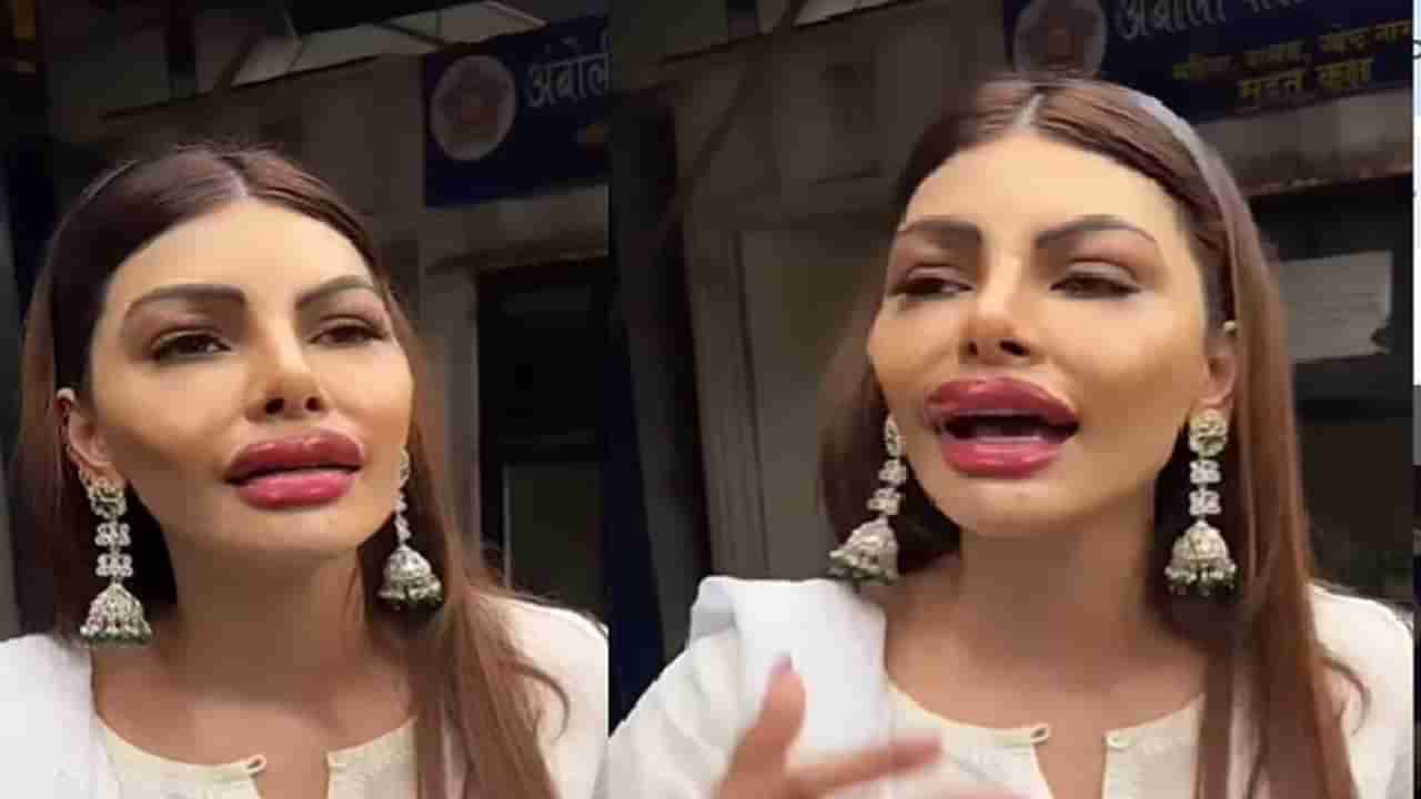 इतके भयानक ओठ... शर्लिनचा व्हिडीओ पाहून नेटकरीच घाबरले - Marathi News | Sherlyn  chopra troll on social media due to lip surgery | TV9 Marathi