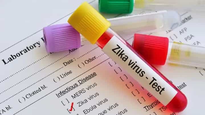 Zika Virus : पुणेकरांनो... काळजी घ्या, झिकाच्या रूग्णांची संख्या 15 वर, 'ही' लक्षणं दिसताच सावध व्हा Zika Virus : पुणेकरांनो... काळजी घ्या, झिकाच्या रूग्णांची संख्या 15 वर, 'ही' लक्षणं दिसताच सावध व्हा