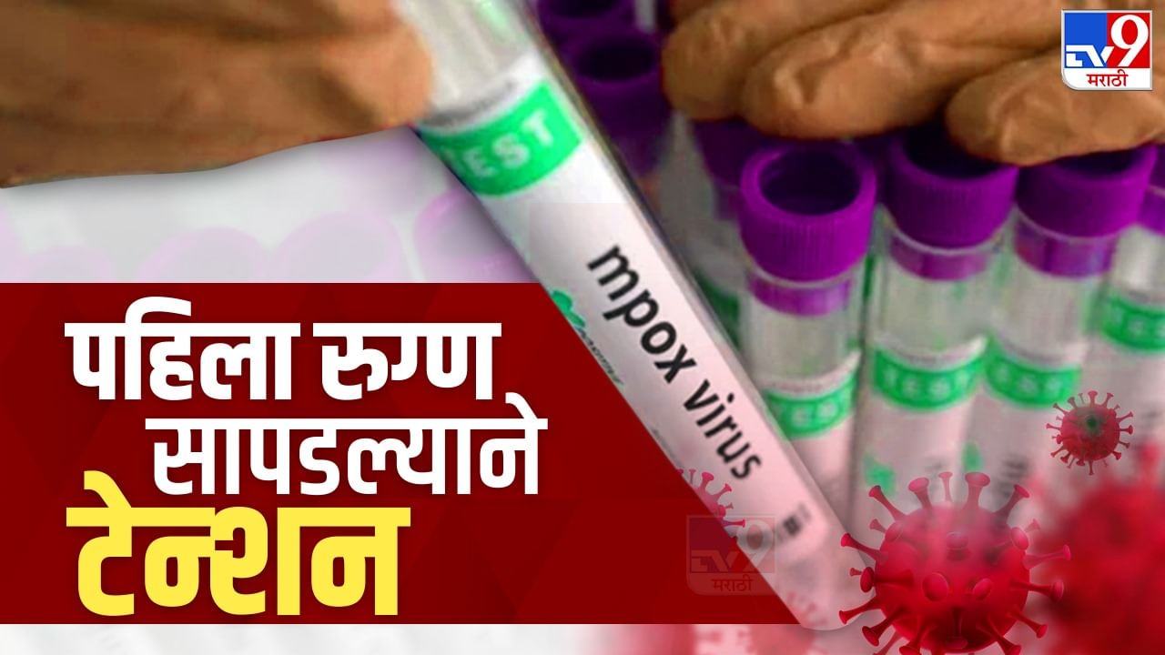 मंकी पॉक्स आजार नेमका काय आहे ? सुरक्षेचे काय आहेत उपाय ? मंकी पॉक्स आजार नेमका काय आहे ? सुरक्षेचे काय आहेत उपाय ?