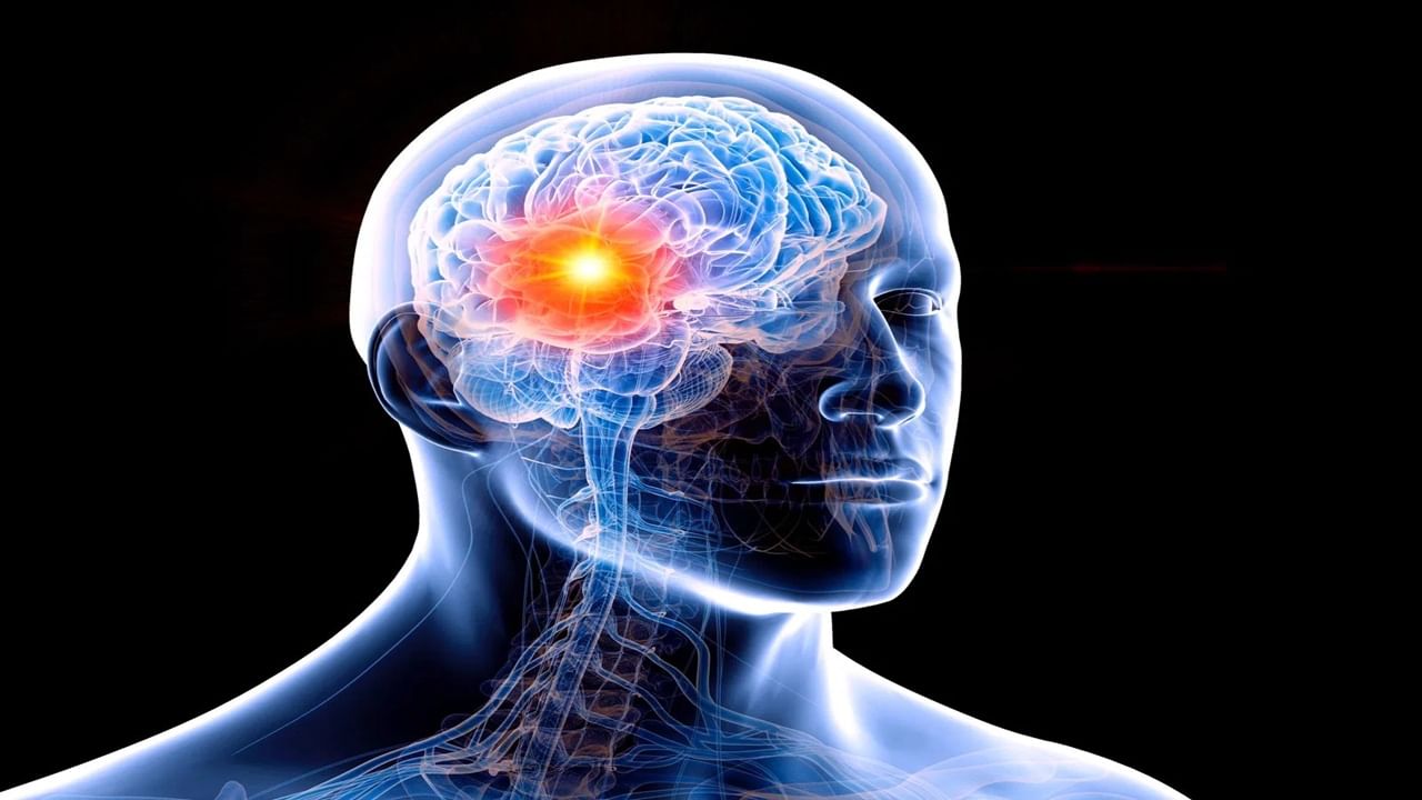 Brain Stroke : ब्रेन स्ट्रोकची ‘ही’प्रमुख लक्षणे, दुर्लक्ष केल्यास मृत्यूचा धोका