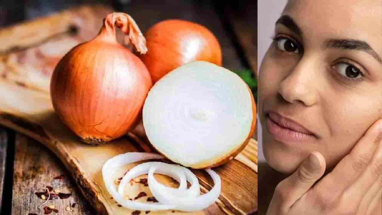 Onion Kitchen Hacks : हे आहेत कांद्याचे आश्चर्यकारक फायदे, जाणून घ्या